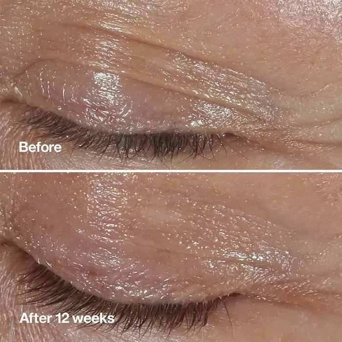 before after Eye Cream CLINIQUE clinical repair